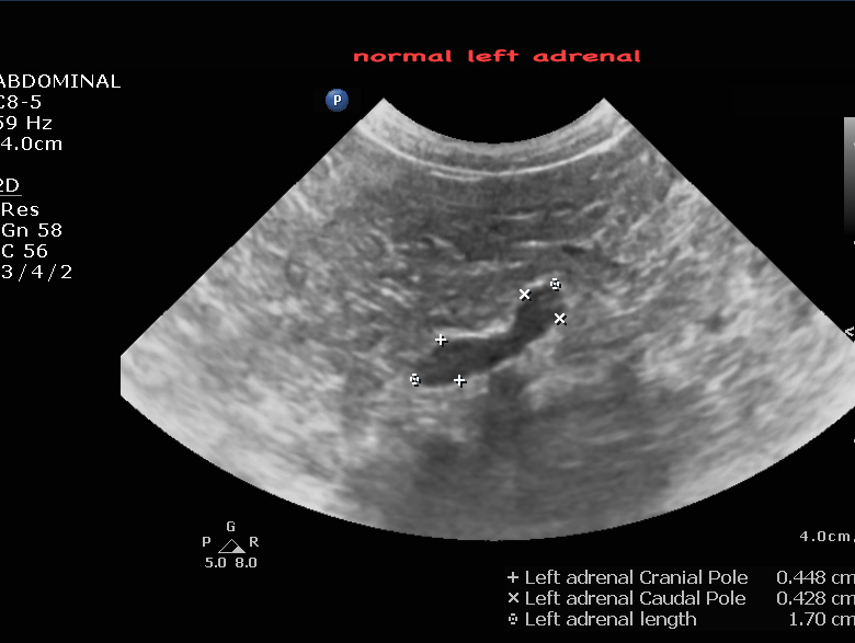 normal adrenal
